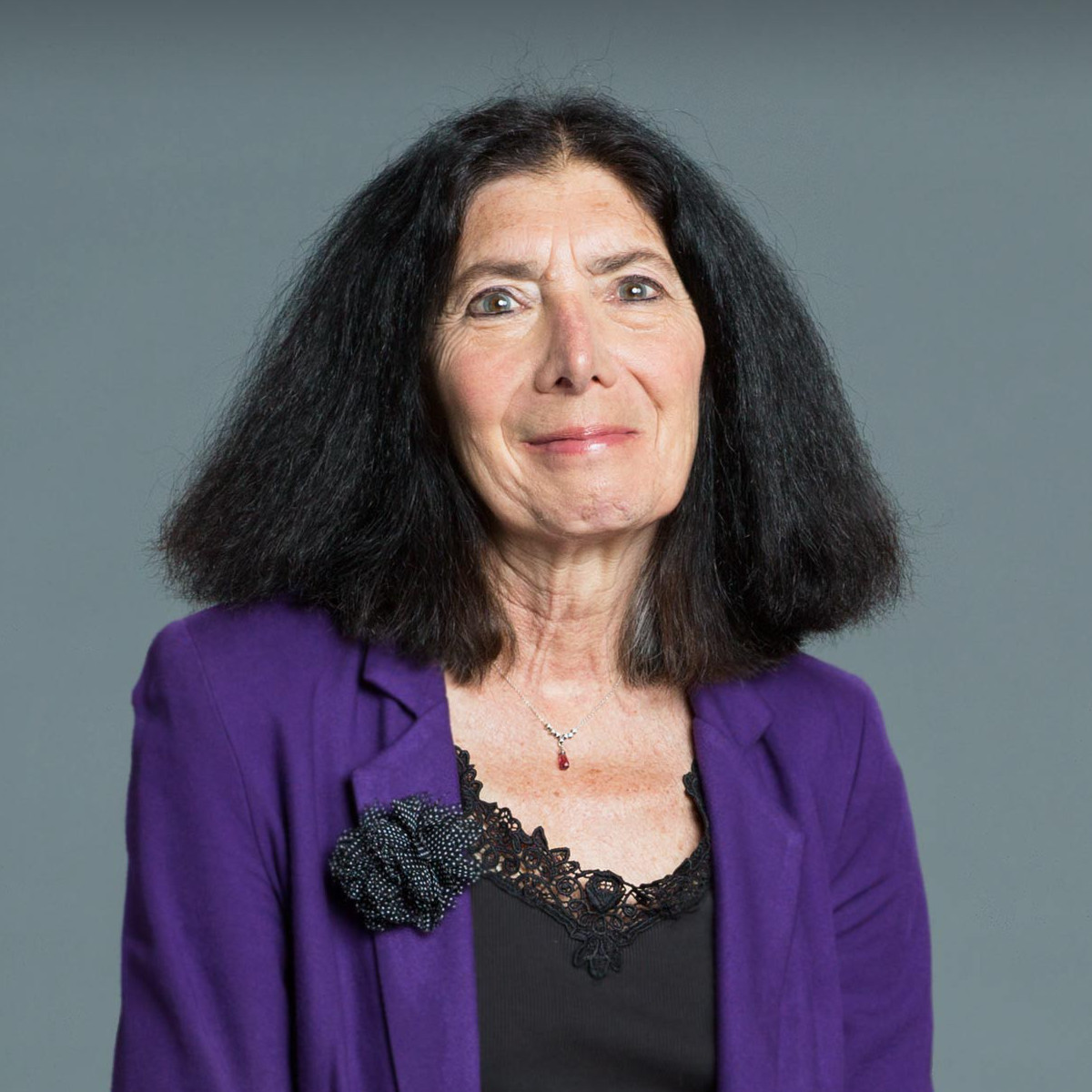 Jill P. Buyon,MD. Lupus